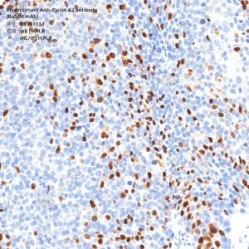 Recombinant Anti-Cyclin A2 antibody (Rabbit mAb)