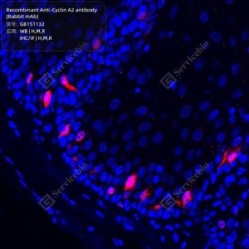 Recombinant Anti-Cyclin A2 antibody (Rabbit mAb)