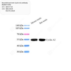 Recombinant Anti-Cyclin A2 antibody (Rabbit mAb)