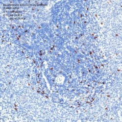Recombinant Anti-Cyclin A2 antibody (Rabbit mAb)