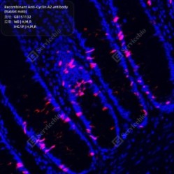 Recombinant Anti-Cyclin A2 antibody (Rabbit mAb)