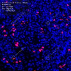 Recombinant Anti-Cyclin A2 antibody (Rabbit mAb)