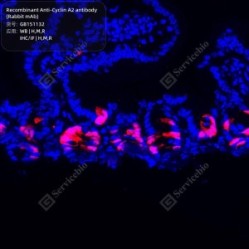 Recombinant Anti-Cyclin A2 antibody (Rabbit mAb)