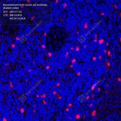 Recombinant Anti-Cyclin A2 antibody (Rabbit mAb)