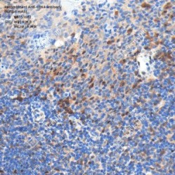 Recombinant Anti-CDK4 antibody (Rabbit mAb)