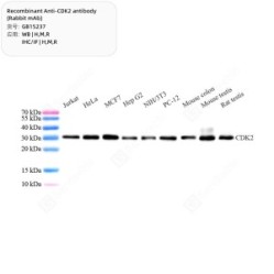 Recombinant Anti-CDK2 antibody (Rabbit mAb)