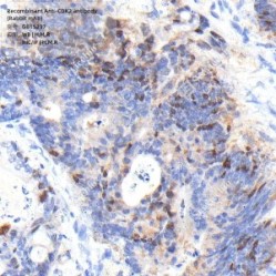 Recombinant Anti-CDK2 antibody (Rabbit mAb)