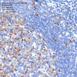 Recombinant Anti-CDK2 antibody (Rabbit mAb)