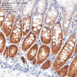 Recombinant Anti-CDK2 antibody (Rabbit mAb)