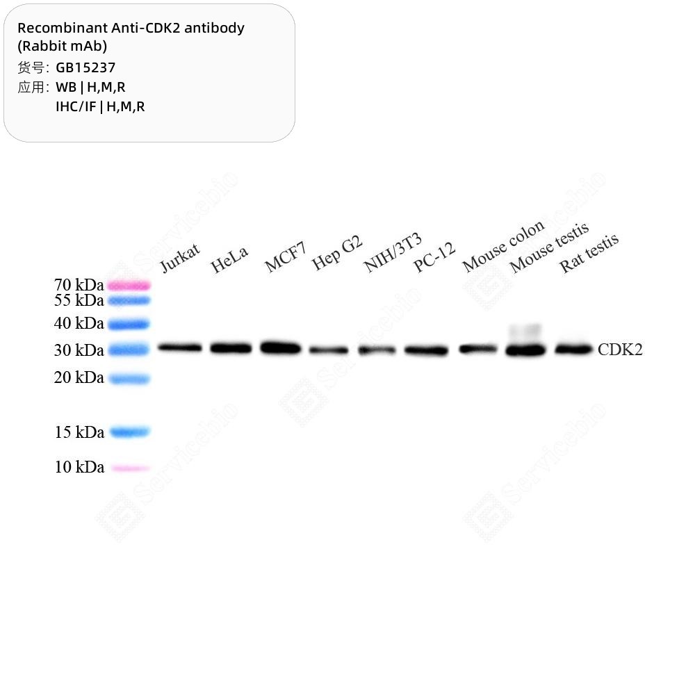 Recombinant Anti-CDK2 antibody (Rabbit mAb)