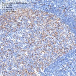 Recombinant Anti-CDK2 antibody (Rabbit mAb)