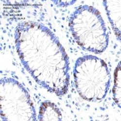 Recombinant Anti-CDK2 antibody (Rabbit mAb)