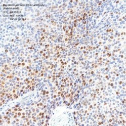 Recombinant Anti-CDK2 antibody (Rabbit mAb)