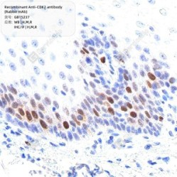Recombinant Anti-CDK2 antibody (Rabbit mAb)