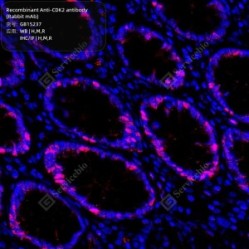 Recombinant Anti-CDK2 antibody (Rabbit mAb)