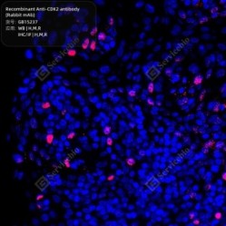 Recombinant Anti-CDK2 antibody (Rabbit mAb)