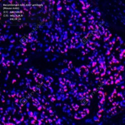 Recombinant Anti-Ki67 antibody (Mouse mAb)