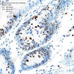 Recombinant Anti-Ki67 antibody (Mouse mAb)