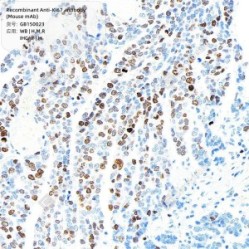 Recombinant Anti-Ki67 antibody (Mouse mAb)