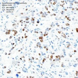 Recombinant Anti-Ki67 antibody (Mouse mAb)