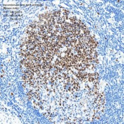 Recombinant Anti-Ki67 antibody (Mouse mAb)
