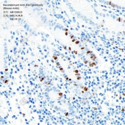Recombinant Anti-Ki67 antibody (Mouse mAb)