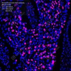 Recombinant Anti-Ki67 antibody (Mouse mAb)