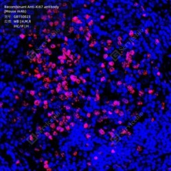 Recombinant Anti-Ki67 antibody (Mouse mAb)