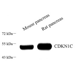 Anti-p57 Kip2 Rabbit pAb, Primary Antibody