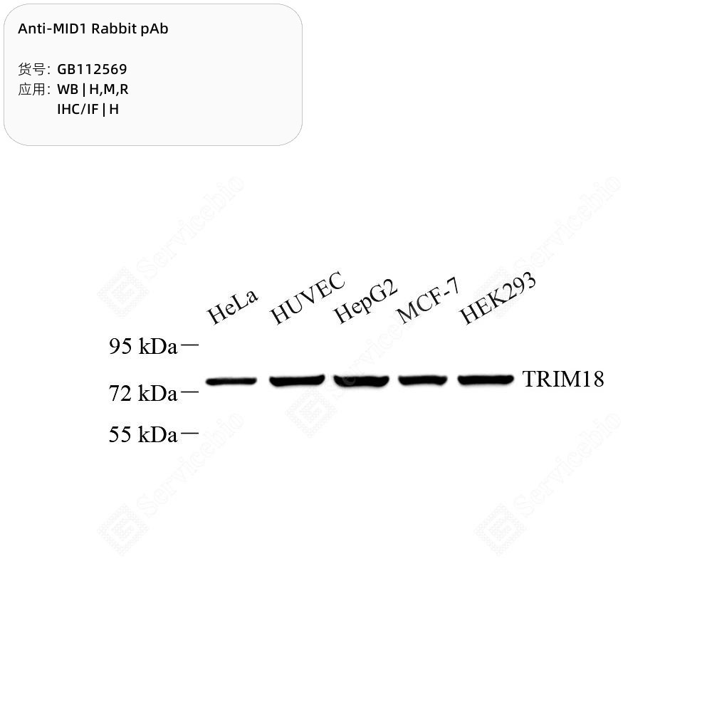 Anti-MID1 Rabbit pAb