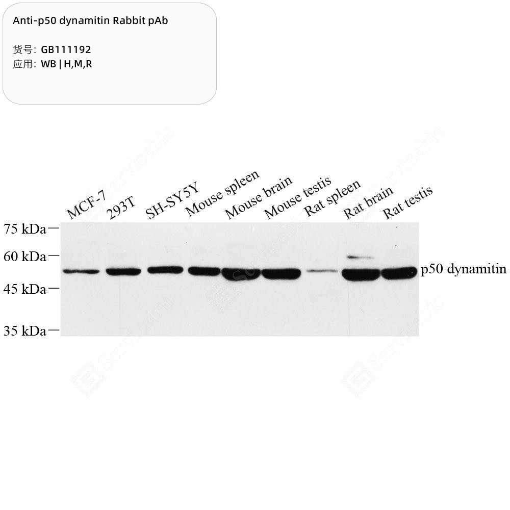 Anti-p50 dynamitin Rabbit pAb