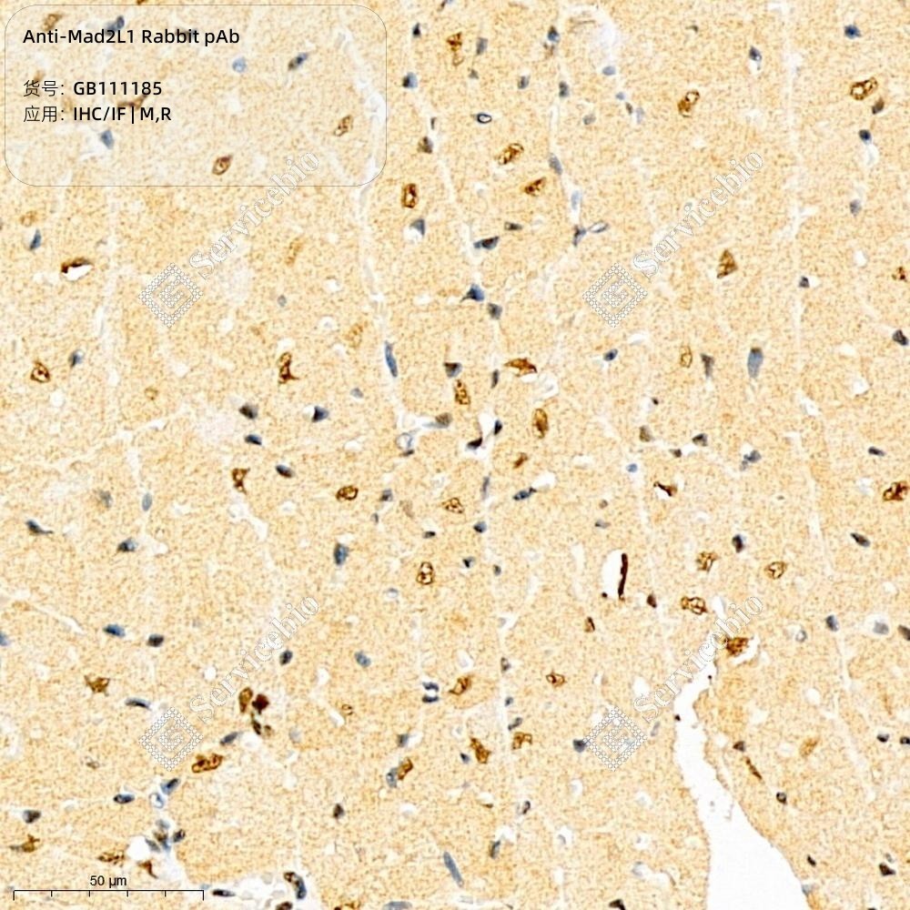 Anti-Mad2L1 Rabbit pAb