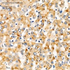 Anti-p70 S6 Kinase Rabbit pAb