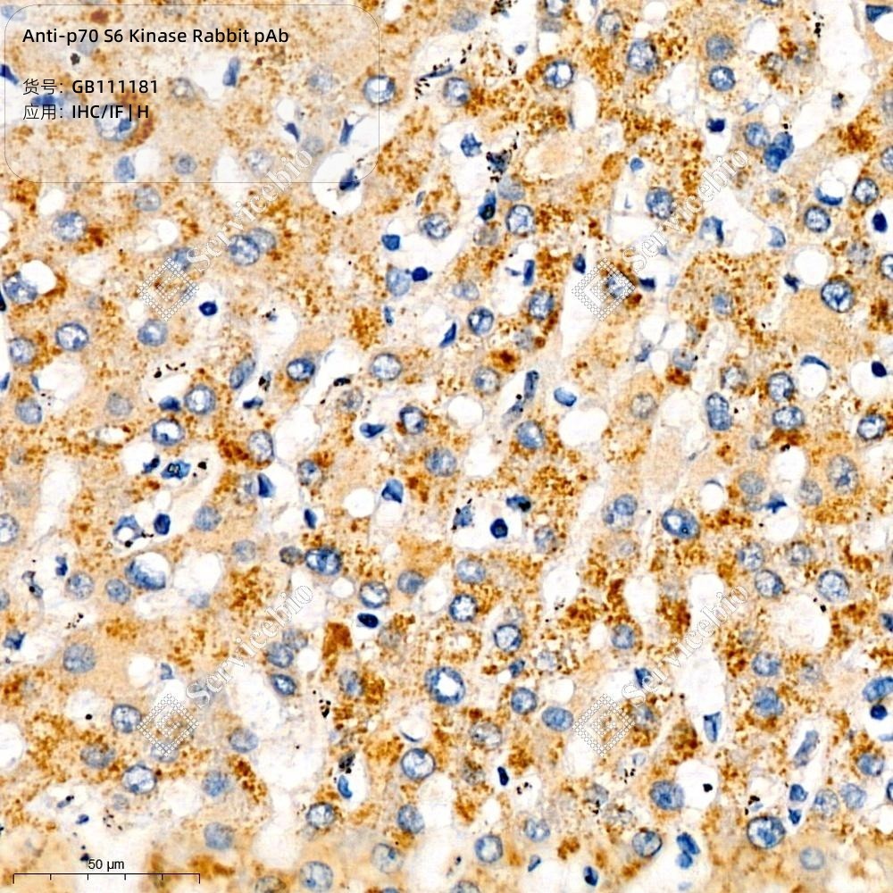 Anti-p70 S6 Kinase Rabbit pAb