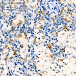Anti-p70 S6 Kinase Rabbit pAb