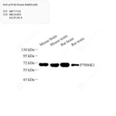 Anti-p70 S6 Kinase Rabbit pAb