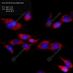 Anti-p70 S6 Kinase Rabbit pAb