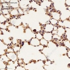Anti-HIPK2 Rabbit pAb