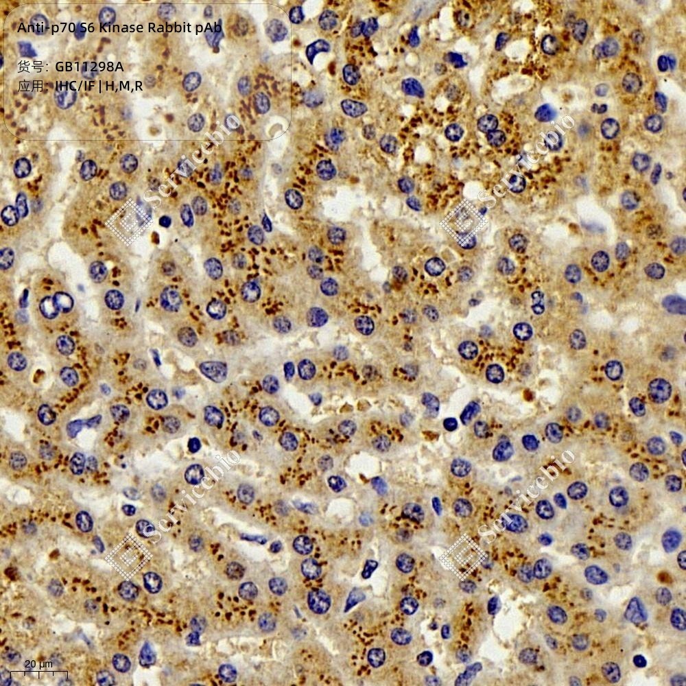 Anti-p70 S6 Kinase Rabbit pAb