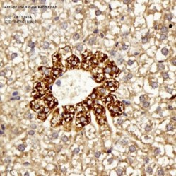 Anti-p70 S6 Kinase Rabbit pAb