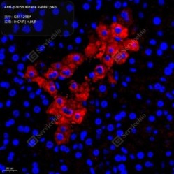 Anti-p70 S6 Kinase Rabbit pAb