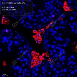 Anti-p70 S6 Kinase Rabbit pAb