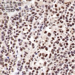 Anti-p27 KIP 1 Rabbit pAb
