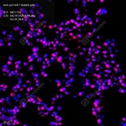 Anti-p27 KIP 1 Rabbit pAb