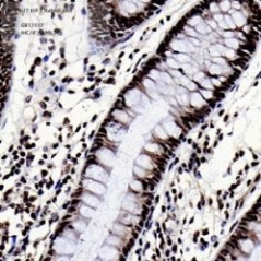 Anti-p27 KIP 1 Rabbit pAb