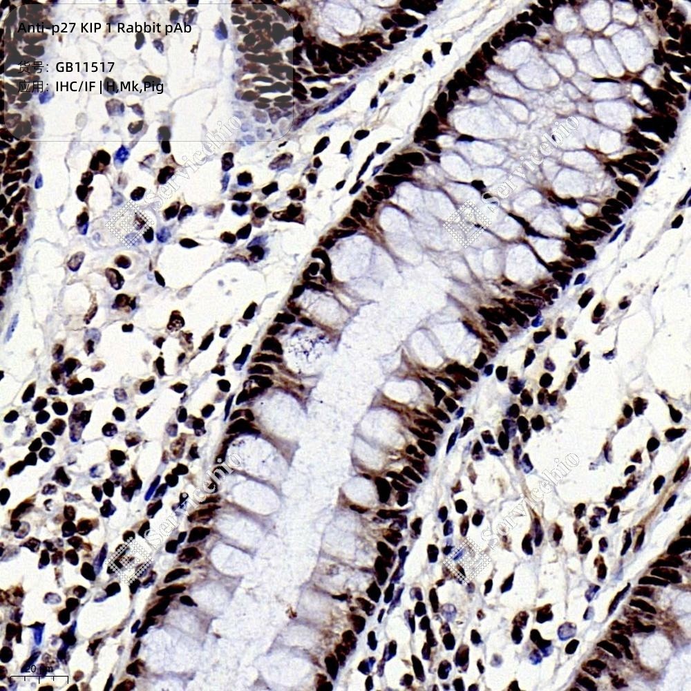 Anti-p27 KIP 1 Rabbit pAb