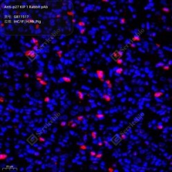 Anti-p27 KIP 1 Rabbit pAb