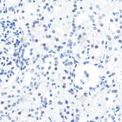 Anti-p27 KIP 1 Rabbit pAb