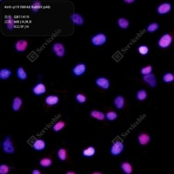 Anti-p19 INK4d Rabbit pAb