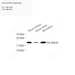 Anti-p18 INK4c Rabbit pAb